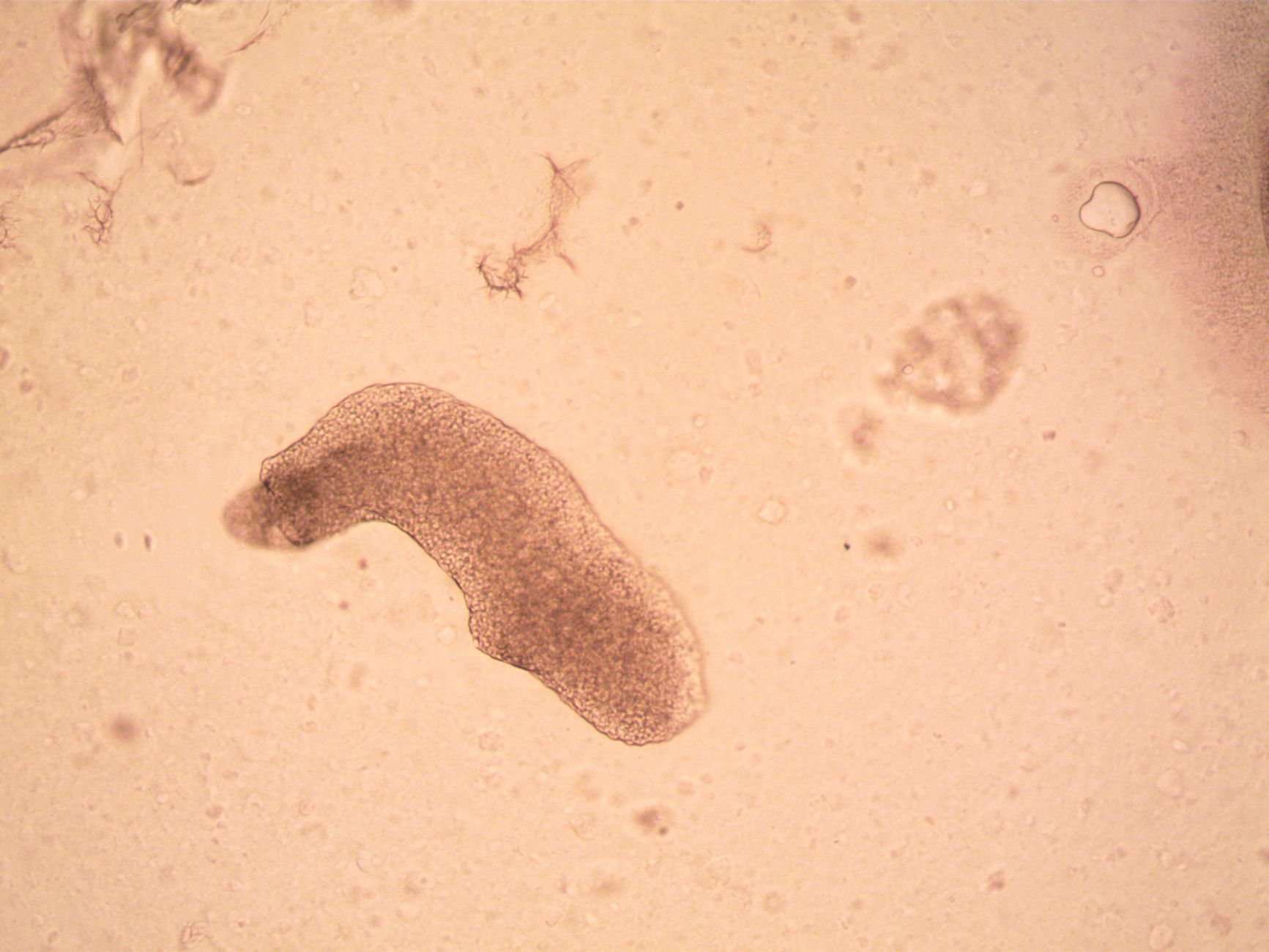 Tardigrades in Space: Proven Survival Against Harsh Conditions
